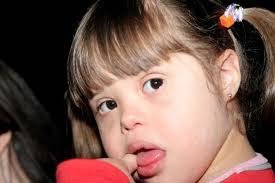 imagen de una nena con sindrome Down