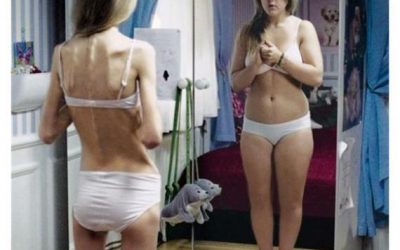 Tenía anorexia severa, se recuperó y hoy inspira a millones en Instagram